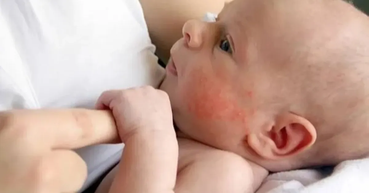 Uzman emzirme danışmanı Sena Türkkan, alerjik bebeklerde emzirme düzenine dair