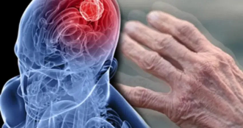 Parkinson, özellikle hareketle ilgili problemlere yol açarak hastanın yaşam kalitesini