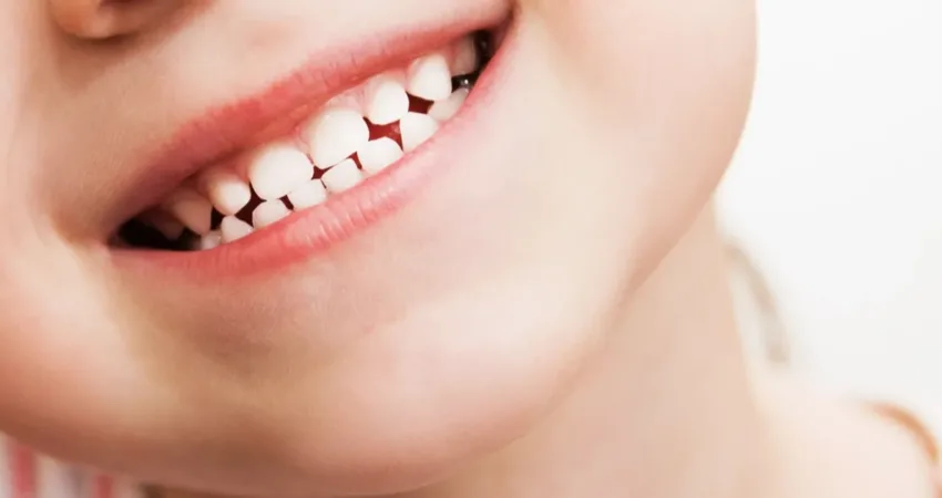 Çocuk Diş Hekimliği Uzmanı Dt. Nurgül Demir, yetişkinlerde bile diş