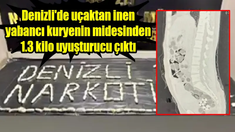 İstanbul’dan Denizli’de havayoluyla yolculuk eden yabancı yolcunun midesinden 219 paket