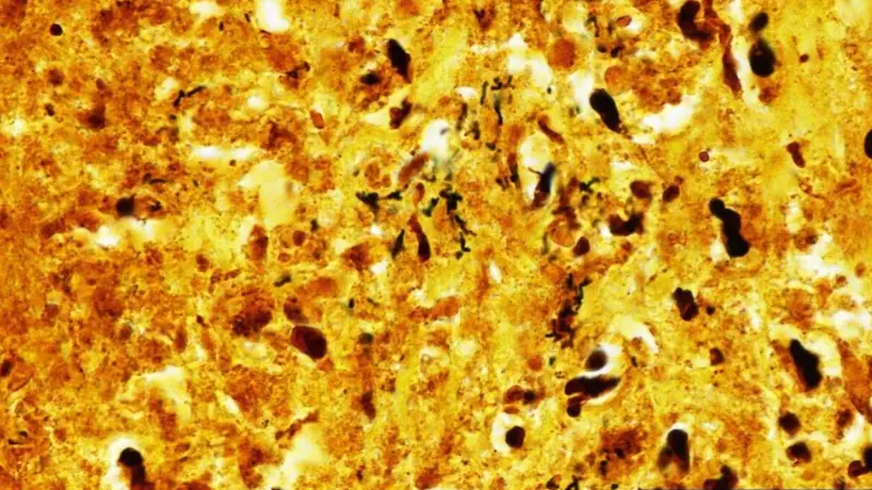 Uluslararası bir araştırma ekibi, uzayın derinliklerinde daha önce görülmemiş bir