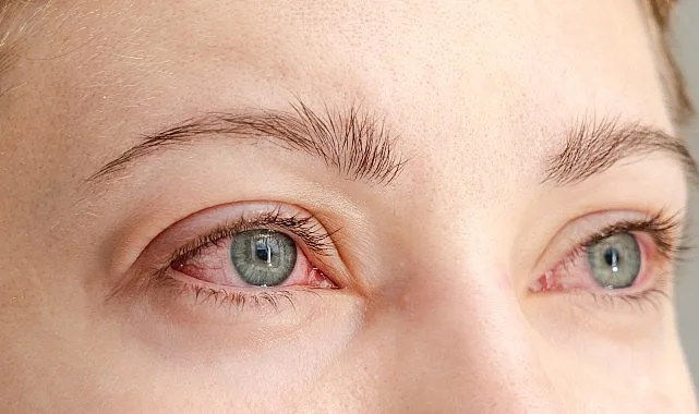 Uzmanlar, özellikle tüketiminin arttığı bayram döneminde şekerin gözler üzerinde oluşturabileceği