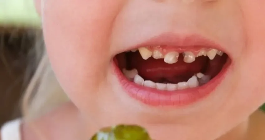 Okul kantinlerindeki masum görünen atıştırmalıklar çocukların dişlerini tehdit ediyor. Uzmanlar,