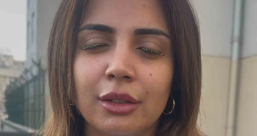 Güzellik merkezinde genç kadının gözüne yapıştırıcı kaçtı: “Kör olabilirdim” Dilara Çalışkan, İstanbul Esenyurt'ta bir güzellik salonunda kirpik işlemi sırasında