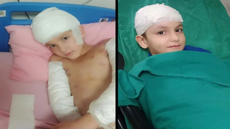 Ankara 8. İdare Mahkemesi, sahipsiz köpeklerin saldırısı sonucu ağır yaralanan