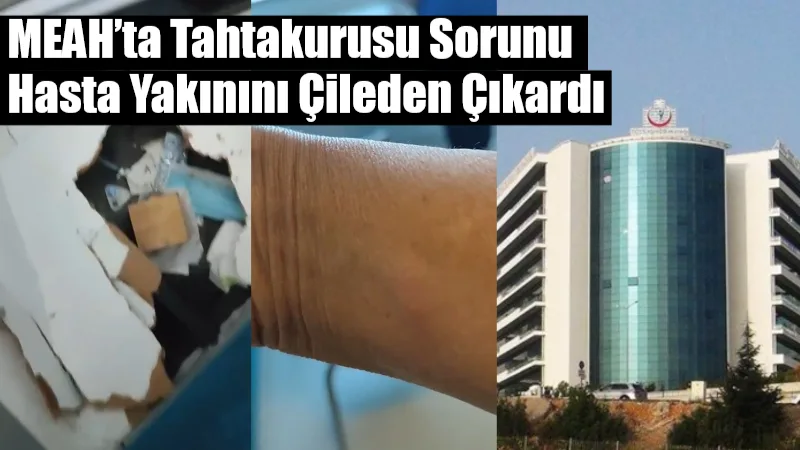 Muğla Sıtkı Koçman Üniversitesi Eğitim ve Araştırma Hastanesi Nöroloji Servisi’nde