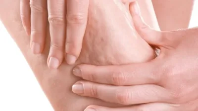 Estetik ve Plastik Cerrahi Uzmanı Prof. Dr. Ahmet Karacalar, selülitin