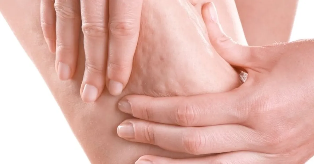 Estetik ve Plastik Cerrahi Uzmanı Prof. Dr. Ahmet Karacalar, selülitin