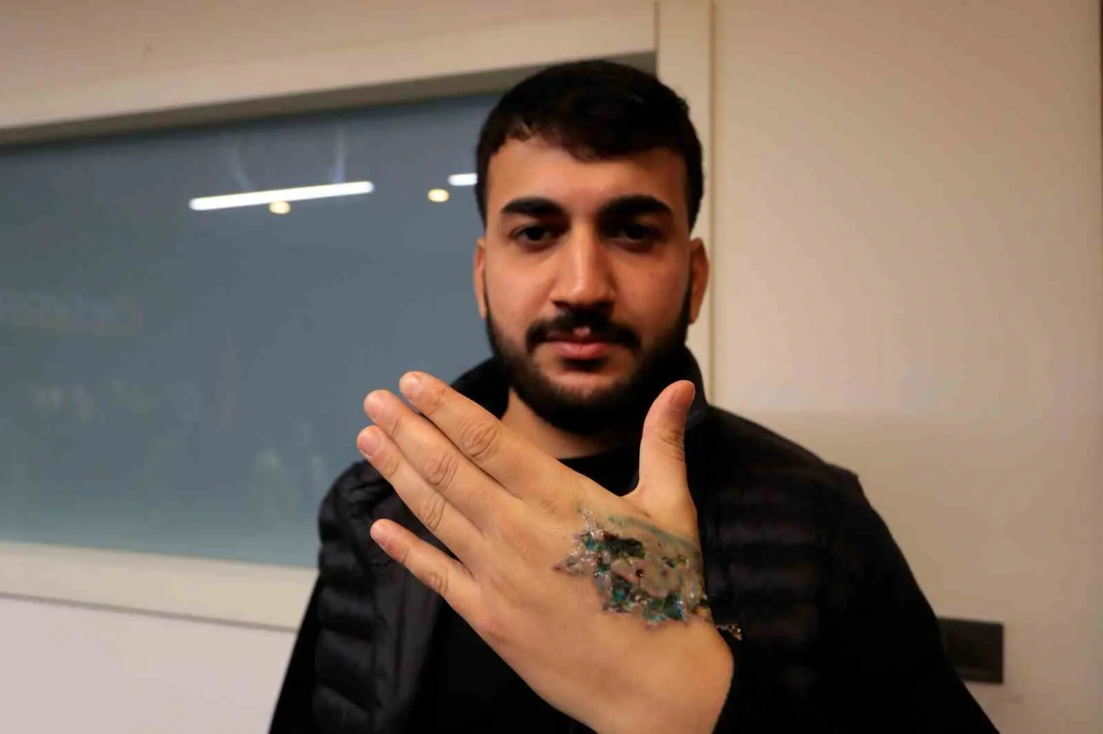 Antalya’da yaşayan Yasin Taş, Batman’da bir güzellik merkezinde yaptırdığı hatalı