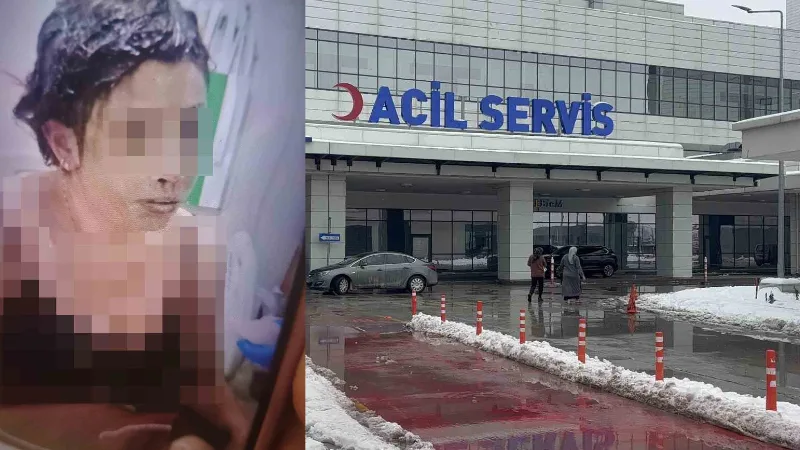 Gaziantep’te S.Ç. (31), eski eşi A.K. (36) tarafından kezzapla ağır