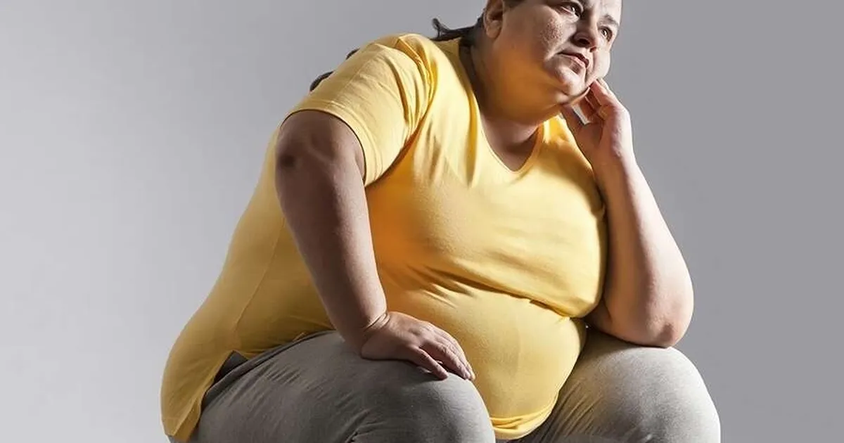 Obezitenin sağlığı bozacak düzeyde aşırı yağ dokusu birikimi ile karakterize