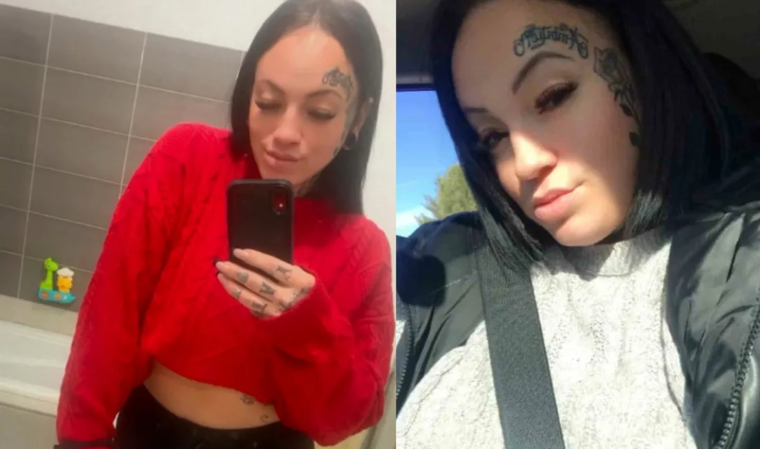 Kanada’dan Antalya’ya estetik operasyon için gelen 35 yaşındaki Jessika Chagnon