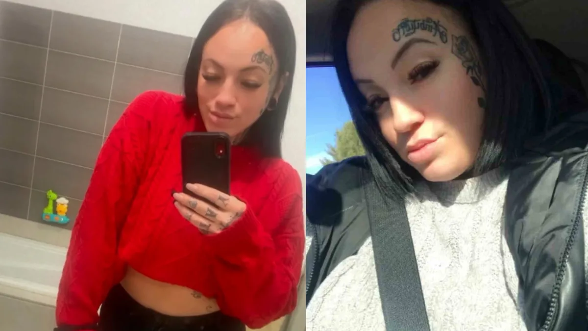 Kanada’dan Antalya’ya estetik operasyon için gelen 35 yaşındaki Jessika Chagnon