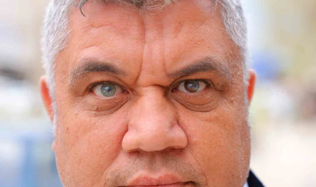 Kahramanmaraşlı 47 yaşındaki Mehmet Eser, bir gözü mavi diğer gözü