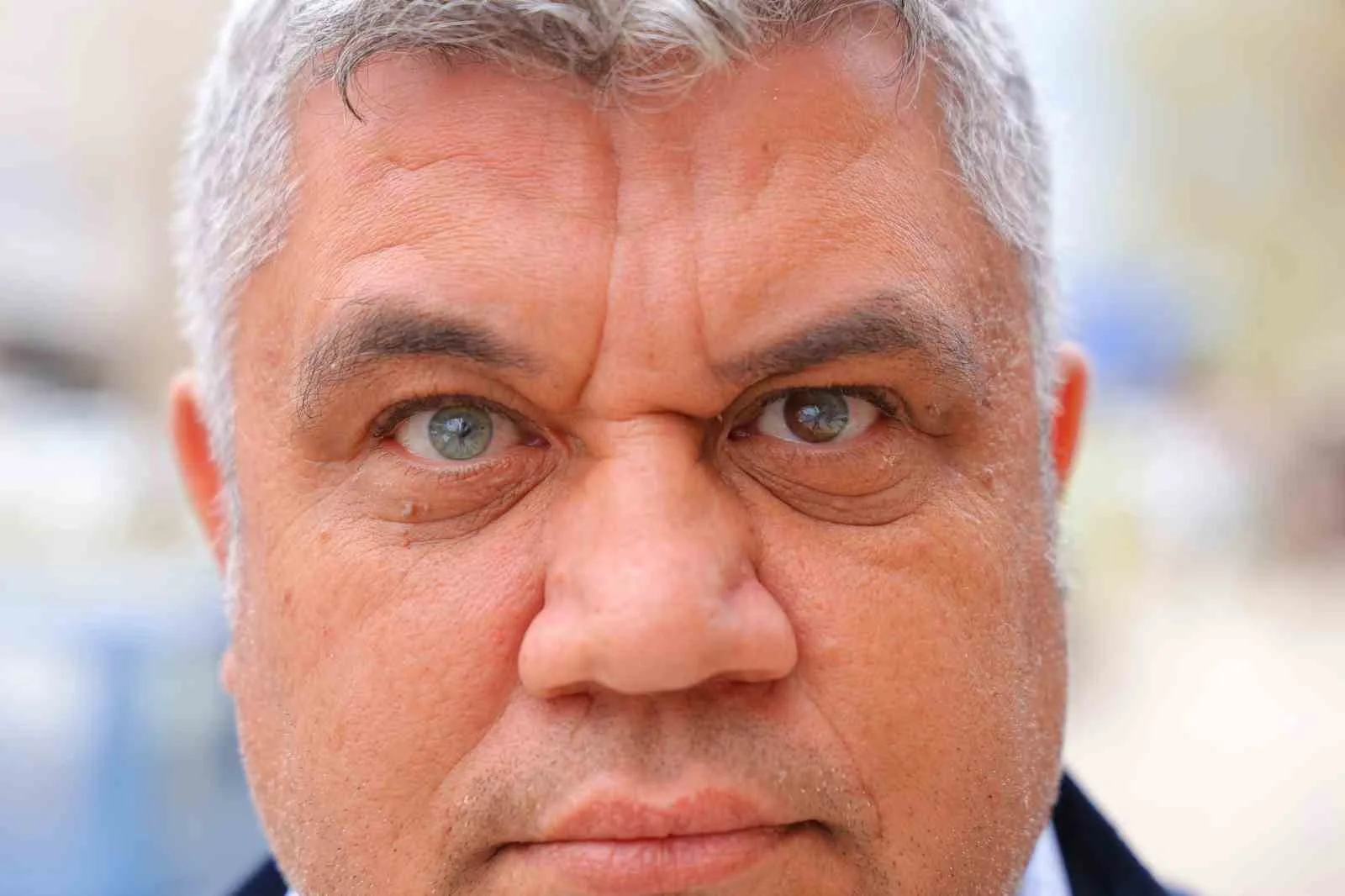 Kahramanmaraşlı 47 yaşındaki Mehmet Eser, bir gözü mavi diğer gözü