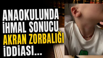 Muğla'nın Menteşe ilçesindeki bir anaokulunda, öğretmenin olmadığı sırada sınıf arkadaşı